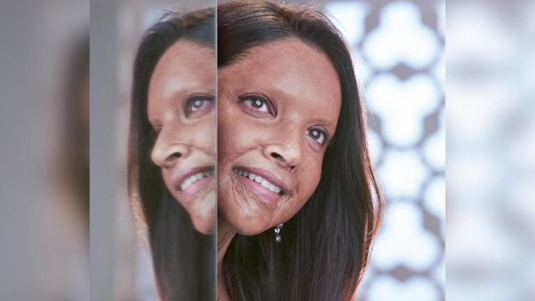 Deepika Padukone to play acid attack survivor in the film Chhapaak