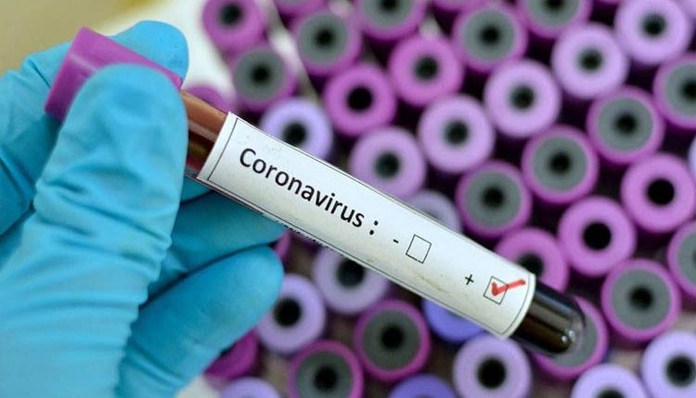 As the world gears up to stop Coronavirus pandemic, the Pakistani regime is deliberately spreading this deadly virus across Balochistan.