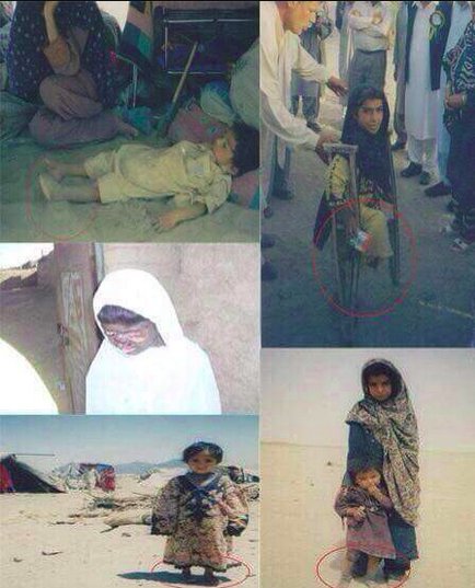 Pakistan's nuclear tests on May 28, 1998 at Chagi, Balochistan has created serious health problems for Baloch people.