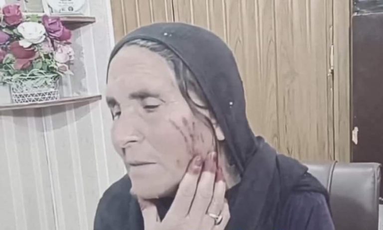 pashtun woman injured